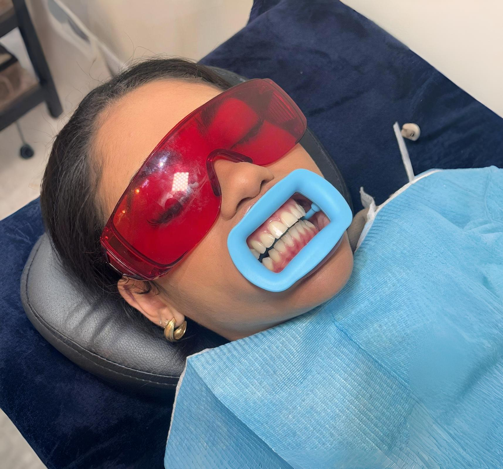 Your First Professional Whitening Session